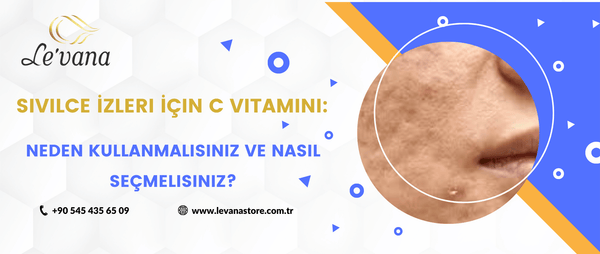 Sivilce izleri için C vitamini serumu kullanımı, izlerin azalmasına ve cildin yenilenmesine yardımcı olur. Levana’nın doğal ürünleriyle cildinizi koruyun.